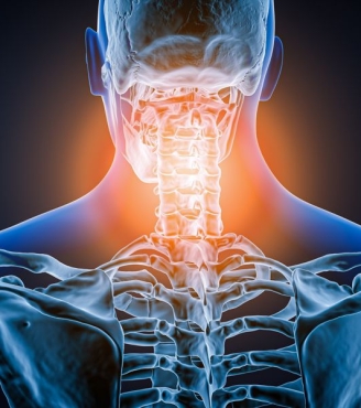 Αυχενιακή κεφαλαλγία